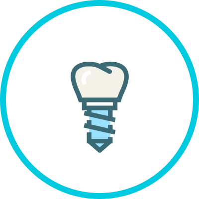 Dental Implant